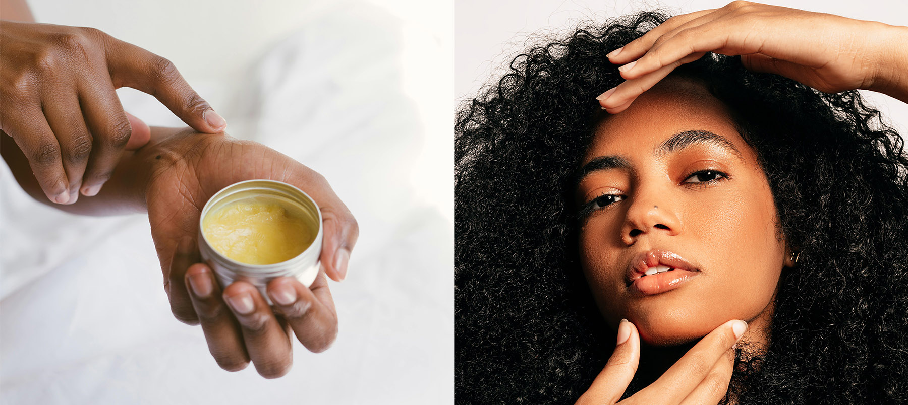 Afinal, quais procedimentos dermatológicos são seguros para pele negra?